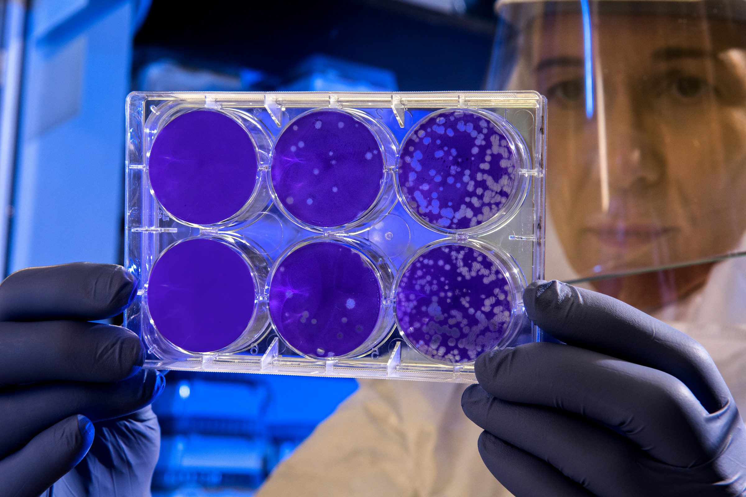Cientistas criam antibiótico que pode matar bactérias resistentes