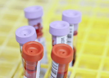 Sangue - HIV - Pesquisa