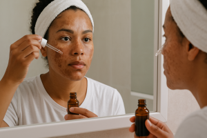 Mulher com melasma usando produtos dermatológicos com conta-gotas em frente ao espelho