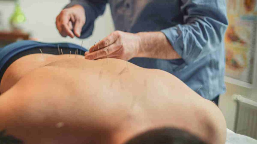 Profissional do SUS aplica acupuntura em paciente como parte das terapias SUS gratuitas