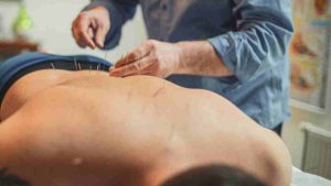 Profissional do SUS aplica acupuntura em paciente como parte das terapias SUS gratuitas