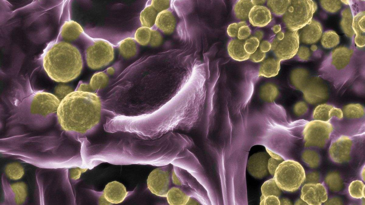 Fungo que transforma minerais em ouro, coberto por nanopartículas douradas em experimento científico.