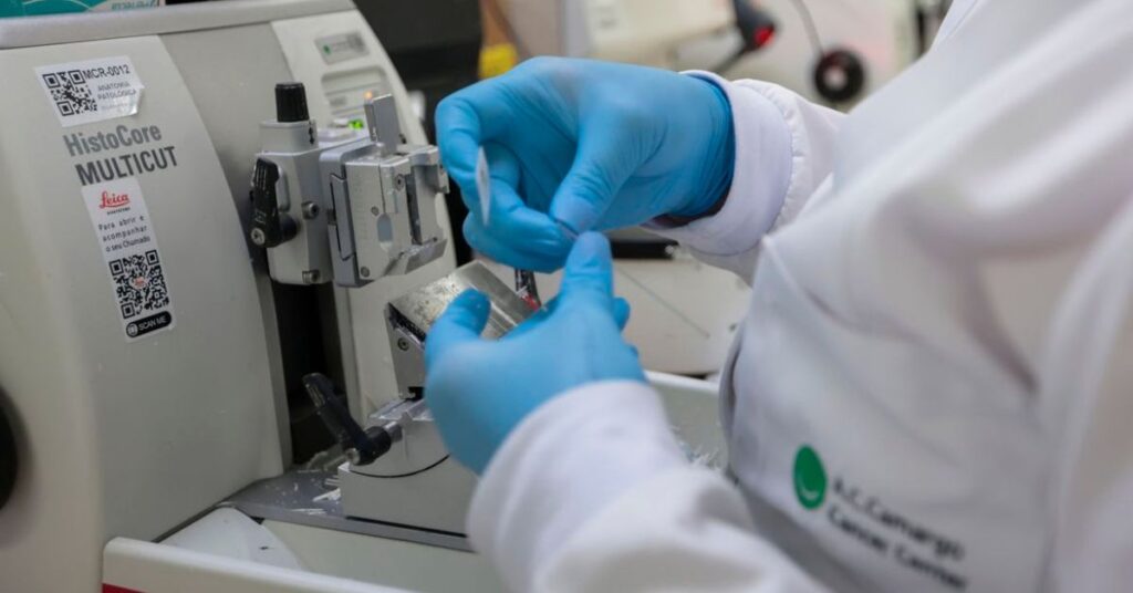 profissional de laboratório analisa amostra relacionada ao diagnóstico do câncer de próstata