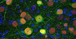 Microscopia celular do estudo da amígdala e neurociência revela neurônios da amígdala basolateral marcados por vírus modificado