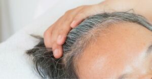 Fios brancos na raiz do cabelo enquanto uma pessoa toca o couro cabeludo.
