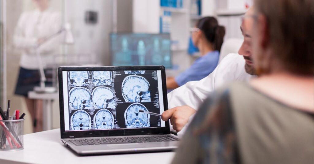 tratamento regenerativo pós AVC explicado por especialistas em neurologia