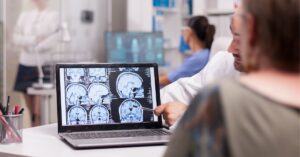 tratamento regenerativo pós AVC explicado por especialistas em neurologia