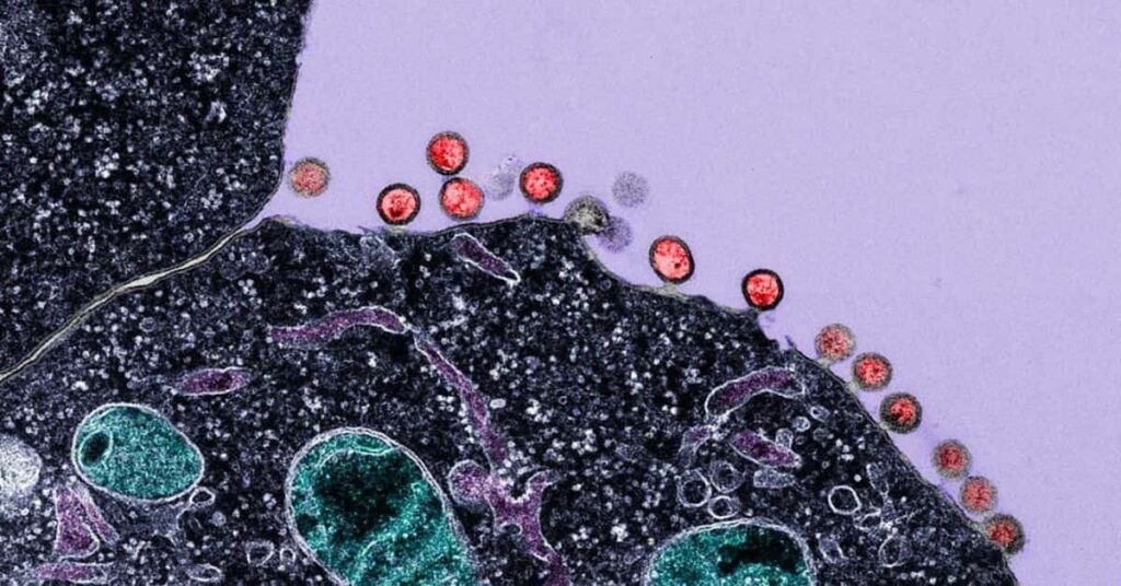 células infectadas analisadas em pesquisa de imunoterapia para HIV