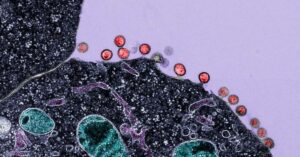 células infectadas analisadas em pesquisa de imunoterapia para HIV