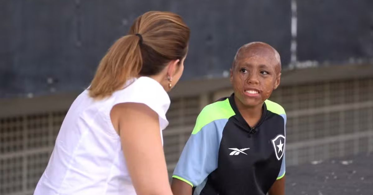 menino supera queimaduras e treina no Estádio Nilton Santos pelo Botafogo