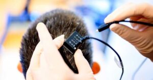 : linguagem para paralisia: IA devolve voz após 18 anos