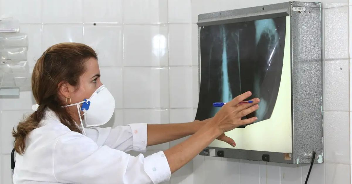 Profissional de saúde analisa raio-x pulmonar para controle da tuberculose no SUS