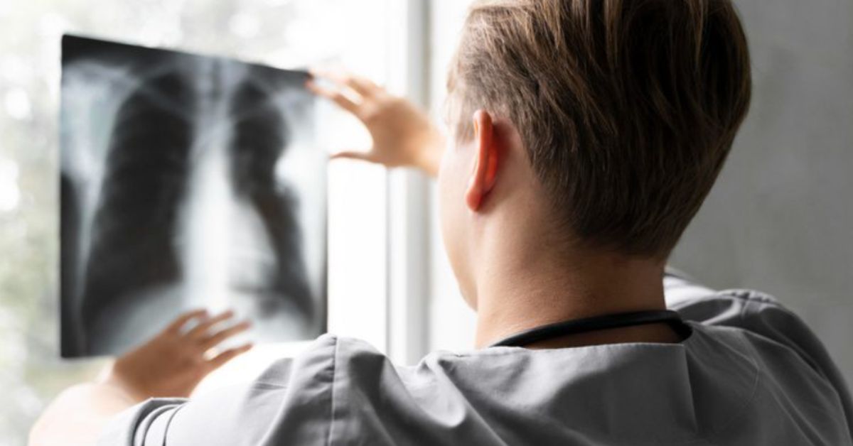 Profissional de saúde analisa exame de raio-x relacionado ao tratamento para câncer de pulmão