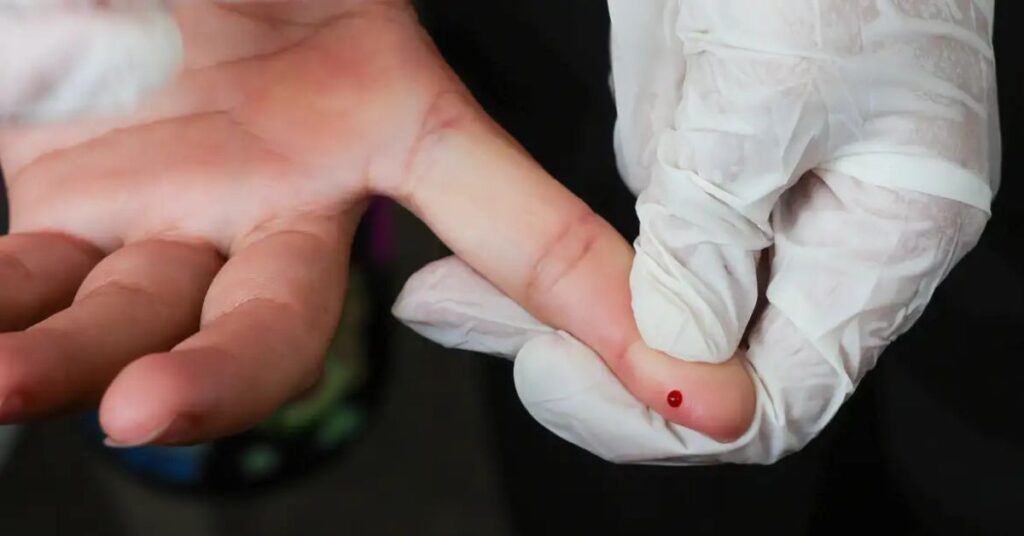 teste rápido de dengue sendo realizado com coleta de sangue no dedo no SUS