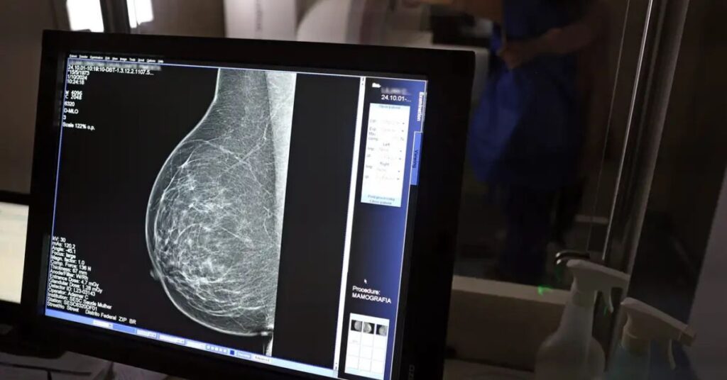 Exame de mamografia realizado com direito à folga para exames preventivos garantida por lei