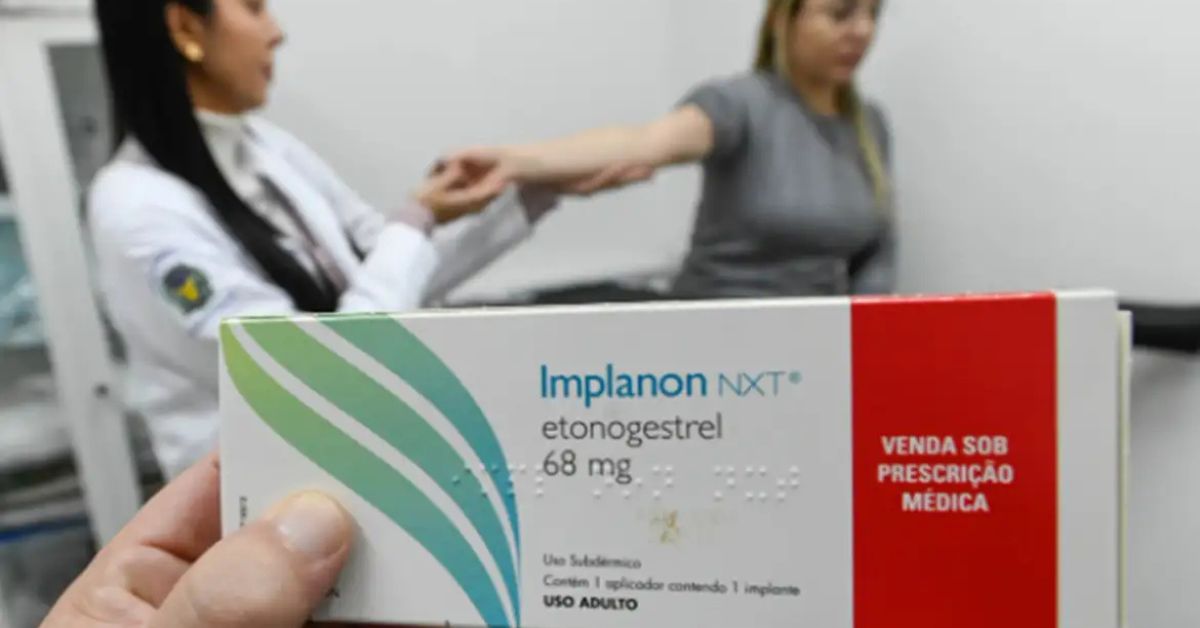implante contraceptivo no SUS Implanon sendo preparado para aplicação em paciente