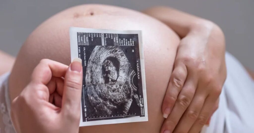 Gestante segura imagem de ultrassom durante monitoramento fetal contínuo em gravidez de risco