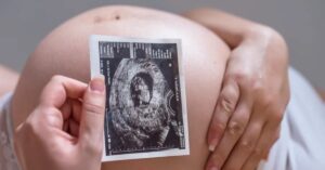 Monitoramento fetal contínuo pode antecipar riscos em gravidez com novo adesivo ultrassônico