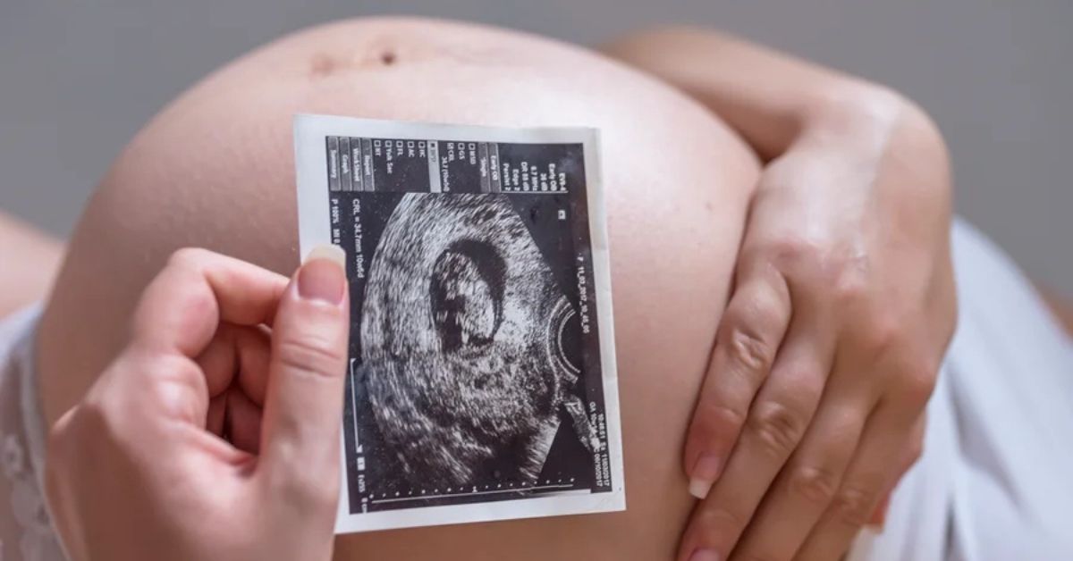 Gestante segura imagem de ultrassom durante monitoramento fetal contínuo em gravidez de risco