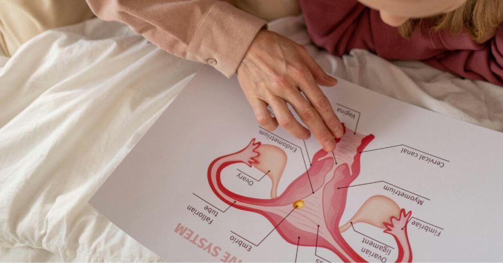 Mulher recebe orientação sobre envelhecimento ovariano enquanto observa ilustração do sistema reprodutor feminino