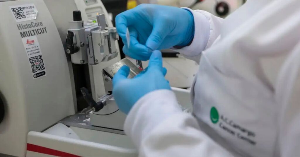 Laboratório realiza análise de amostras relacionadas ao tratamento da leucemia incorporado ao SUS para pacientes com leucemia mieloide aguda