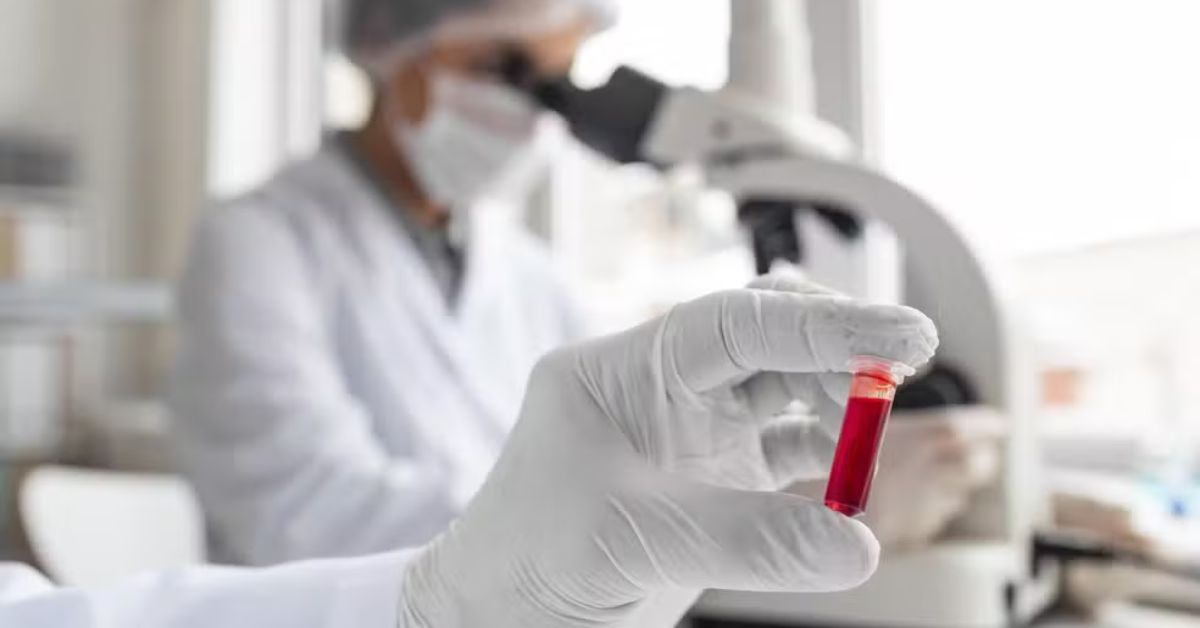 Pesquisador segura amostra em laboratório durante estudo sobre tratamento do mieloma múltiplo com imunoterapia