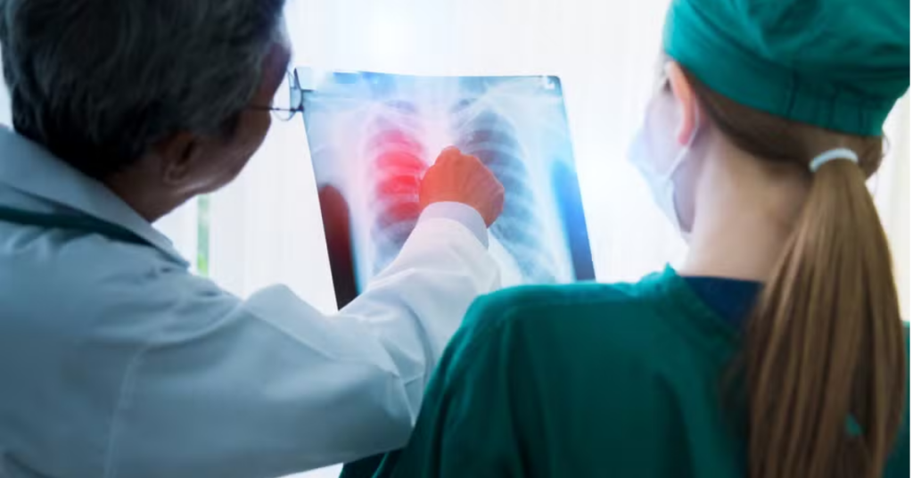 Medicamento para câncer de pulmão: Anvisa aprovou uma nova indicação para o Datroway, tratamento que utiliza tecnologia capaz de concentrar a entrega da quimioterapia nas células tumorais. A novidade amplia as opções para um grupo específico de pacientes.