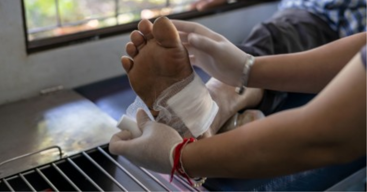 Pesquisadores da USP trabalham em técnica experimental para ajudar na cicatrização de feridas difíceis de fechar.