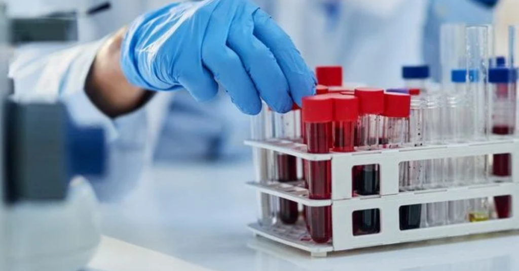 Profissional de laboratório manipula tubos de ensaio durante atividade de pesquisa relacionada à terapia CAR-T no Ceará.