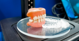 SUS começa a levar próteses dentárias feitas com impressão 3D a 409 municípios