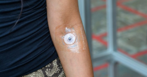 Pesquisadores criam tatuagem sem dor que usa adesivo com agulhas menores que um grão de areia